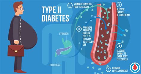 injections diabetes type 2 causes obesity